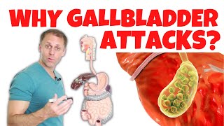 Understanding Gallbladder Attacks [upl. by Boylston505]