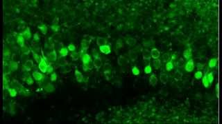 Monitoring neuronal activity in brain slices from a 2 year old Thy1GCaMP3 transgenic mouse [upl. by Sudderth]