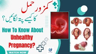 کمزور حمل کا کیسے پتہ لگائیں ؟  How To Know About Unhealthy Pregnancy  Dr Sara Safdar [upl. by Nye478]