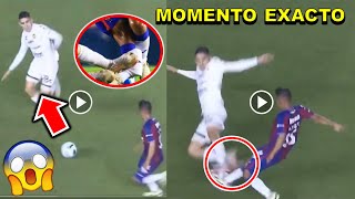 Video completo Lesión de Hobbit Bermúdez Atlante vs Dorados ESTO PASO momento exacto Hobbit Bermúdez [upl. by Linehan]