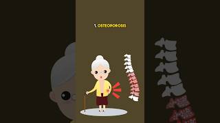 Deficiency of calcium symptoms hypocalcemia lowcalcium calciumdeficiency [upl. by Matazzoni]