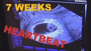 7 weeks 0 days Pregnant ULTRASOUND amp Babys HEARTBEAT ❤️ Early Pregnancy USG  AMAZING [upl. by Suilenroc]