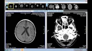 iQVIEW  The Radiology Reading Station [upl. by Aikrehs447]