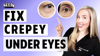 Fix Your Crepey Under Eye Skin  3 AtHome Antiaging Treatments [upl. by Notlew]