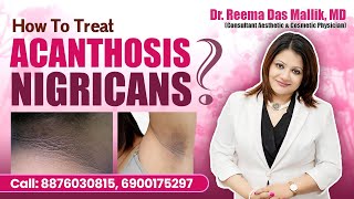 How To Treat ACANTHOSIS NIGRICANS   Dr Reema Das Malik  2024 [upl. by Bobette272]