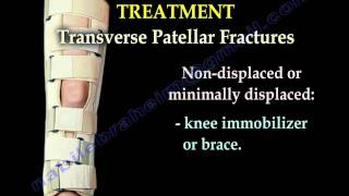 Patellar Fractures  Everything You Need To Know  Dr Nabil Ebraheim [upl. by Ainaled]