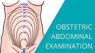 Obstetric Abdominal Examination  Steps for examining a pregnant woman [upl. by Mclyman764]