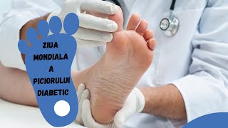 Diabetul Zaharat 10 Sfaturi ca sa NU Ajungi la Amputatie [upl. by Luas]