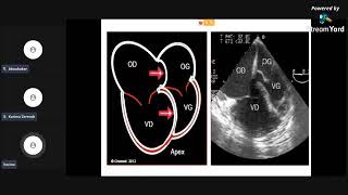 meilleure explication de🤩 Embolie pulmonaire🤩Pr FOUAD cardiologie pneumologie résidanat EVC ECN [upl. by Mervin107]