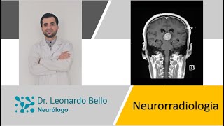 Curso de Neurorradiologia fácil y rapido [upl. by Xuagram]