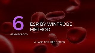 ESR by Wintrobe Method [upl. by Adnalram]