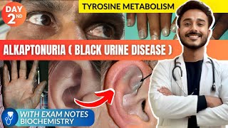 tyrosine metabolism biochemistry  alkaptonuria biochemistry  black urine disease biochemistry [upl. by Onimixam]