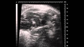 PALong MicroEchocardiography using the Vevo 770 [upl. by Armstrong729]