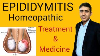 Epididymitis SymptomsCauses and Treatment Homeopathic medicine Testicular Pain DrRamdeo Lamoria [upl. by Yllatan]