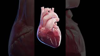 Cardiac tamponade anatomy [upl. by Haelhsa]