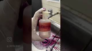 Afb stain  sputum test  test for tb  mycobacterium tuberculosis test [upl. by Romelda]