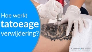 Help een Tattoo Hoe kan je een tatoeage verwijderen [upl. by Cock]