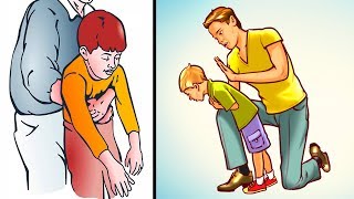 How to Help a Choking Child or Adult Everyone Must Know [upl. by Nevi]