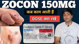 zocon 150  zocon 150 is used for in hindi  zocon 150 tablet  zocon 150 fluconazole [upl. by Wandie849]