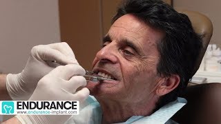 Prothèse amovible  Travail du dentiste et prothésiste  Dr SUBA Hongrie [upl. by Carmelia]