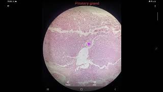 Histology of Pitutaryhypophysis cerebri gland slide identification and explanation [upl. by Map]