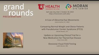 Abnormal Eye Movements Pseudotumor Cerebri Syndrome Thyroid Eye Disease Visual Field Testing [upl. by Kafka]