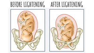 When Labor Will Start if Youre 1 Centimeter Dilated  How to Check a Cervix for Dilation [upl. by Oina]