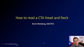 How to read a CT angiogram CTA of the Head and Neck [upl. by Yearwood]