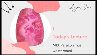 PARASITOLOGYM13 Paragonimus westermani [upl. by Jenifer]