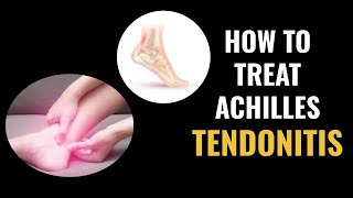 How to treat Achilles Tendonitis [upl. by Aehtela321]