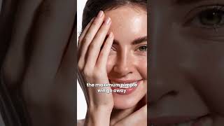 Overnight Acne Fixing Tips [upl. by Janik760]