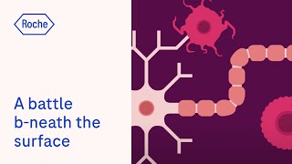 Multiple sclerosis  Battle bneath the surface [upl. by Rimahs]