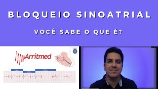 Bloqueio Sinoatrial  Você sabe o que é [upl. by Abelard]