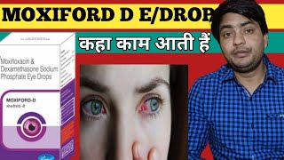 moxiford d eye drop use in hindi  moxiford d eye drop review [upl. by Norrie947]