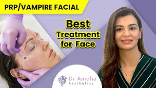 PRP Treatment For Face How Is It Done  Best Cosmetic Treatments in Delhi  Skin Rejuvenation [upl. by Rehpotsihc110]