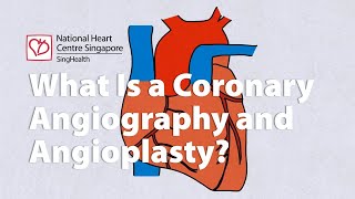 The lifesaving procedure you need to know about  All About Coronary Angiography [upl. by Gierc880]