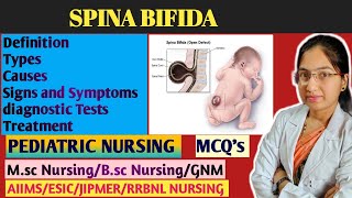 Spina bifida in Pediatric Nursing  Myelomeningocele  Types  Causes  Treatment  Nursing classes [upl. by Jeniece535]