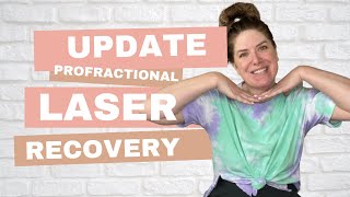 TWO MONTH Post Profractional Laser Update [upl. by Ydnelg]