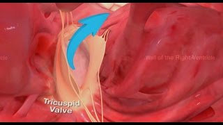 360 video  Tricuspid Valve  Right Ventricle  medmoviecom [upl. by Vitia]