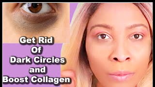 Some Of The Best Creams That Effectively Get Rid Of Dark Circles And Eye Bags [upl. by Editha544]