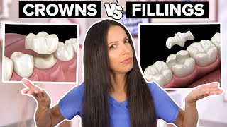 Dental Crowns Vs Dental Fillings Whats the Difference [upl. by Petronille]