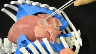 Transannular patch of the pulmonary artery simulation on a 3D printed silicon model [upl. by Aibos]