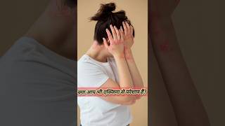 क्या आप भी ड्राई एक्जिमा से परेशान हैं ⚠️dryeczema treatment shortvideo [upl. by Ennad]