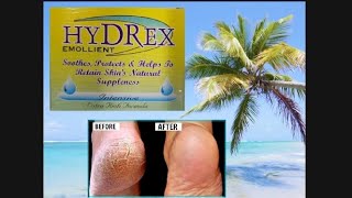 cracked heels  HYDREX EMOLLIEN  SOOTHES PRTECTS amp HELPS TO RETAIN SKINS NATURAL SUPPLENESS [upl. by Nedlog]