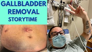 Gallbladder Removal Surgery Recovery Experience amp Symptoms of Gallstones [upl. by Enelyam]