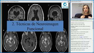 CEUPE Neuroimagen Técnicas de estudio y análisis del cerebro [upl. by Eggett]