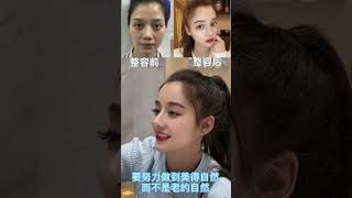 曾经我是医院最丑的一个，现在没人敢说我丑了 medical skincare plastic beautiful beauty 上海 整形 面部提升 [upl. by Cohbath]