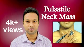 Pulsatile Neck Mass Aetiologies and Diagnosis [upl. by Faus]