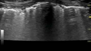 Lung ultrasound video clip from a cat with presumed feline asthma [upl. by Novelia]