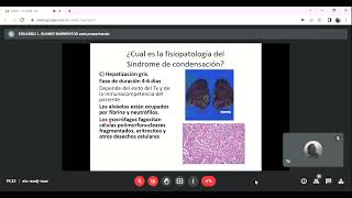 FISIOPATOLOGIA DE LOS SÍNDROMES DE CONDENSACIÓN PULMONAR Y NEUMONÍAS [upl. by Nireil]